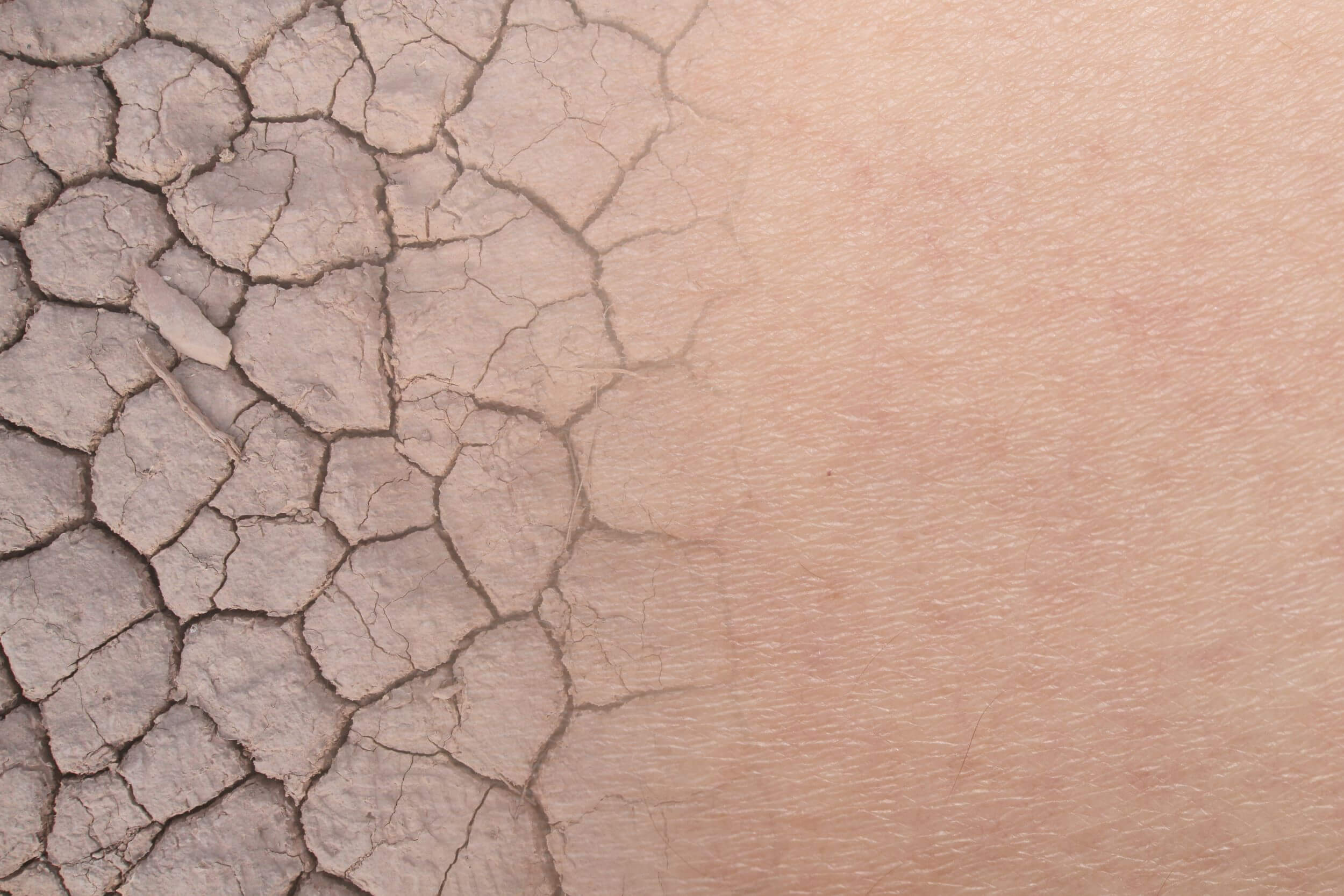 Mi minden lehet a száraz, repedezett bőr oka? Hogyan kezelhető?